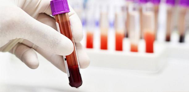 Həkim qan analizlərinin düzgün verilməsi üçün 