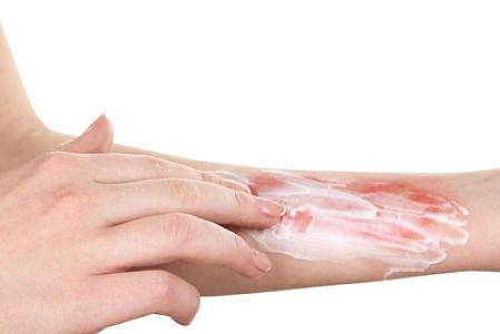 Bunları yanıqlara tətbiq etməyin -