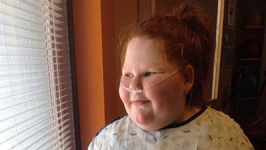 Braziliyada iki yaşlı uşaqda nadir genetik