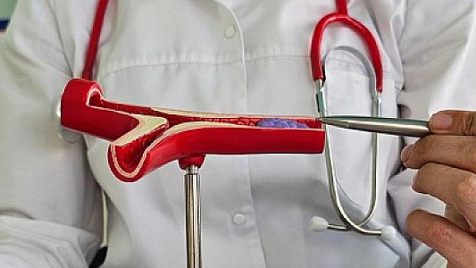 Qan laxtalanmasının təhlükəli əlamətləri – 