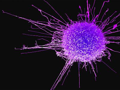 Alimlər mədə-bağırsaq xərçənginin