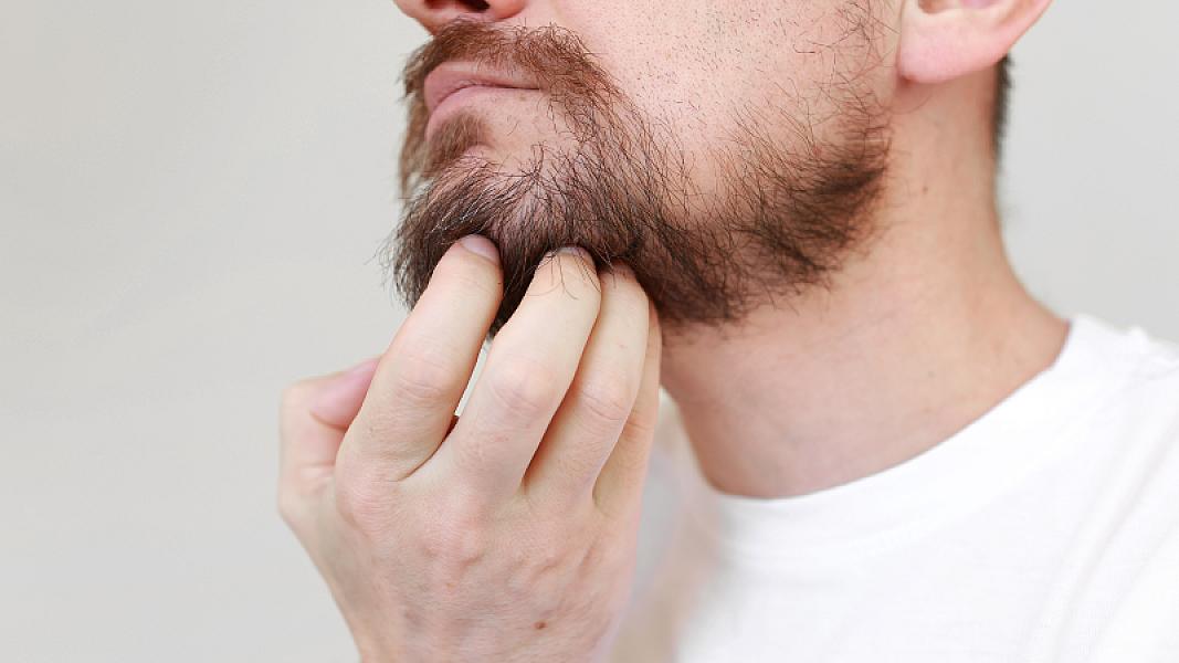 Mütəxəssislər kişilərdə saqqal çıxmamasının gizli 