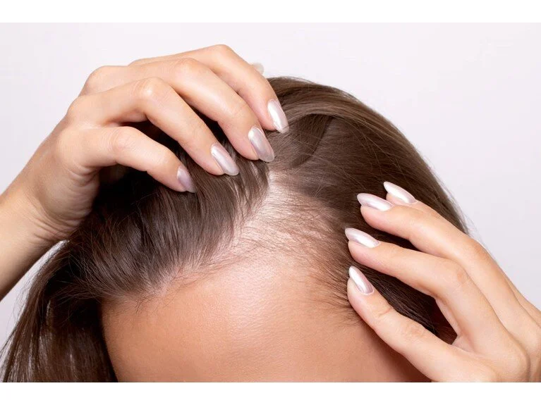Dermatoloq açıqladı: Mövsümi saç tökülməsi