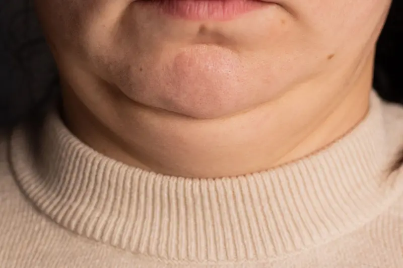 Boyun qalınlığı sağlamlığımız haqqında