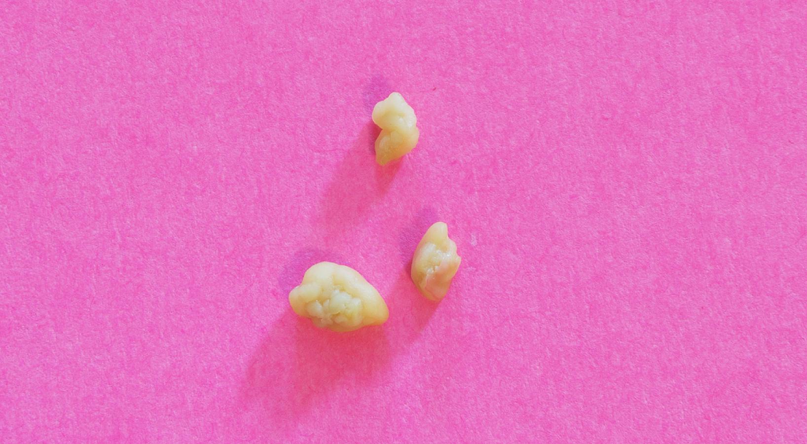 Boğaz daşı xəstəliyi: Səbəblər, simptomlar və