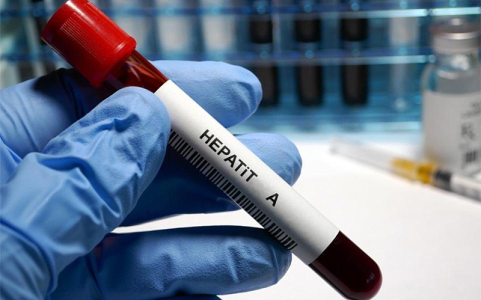 Azərbaycanda hepatit A virusuna yoluxma halları azalıb? -
