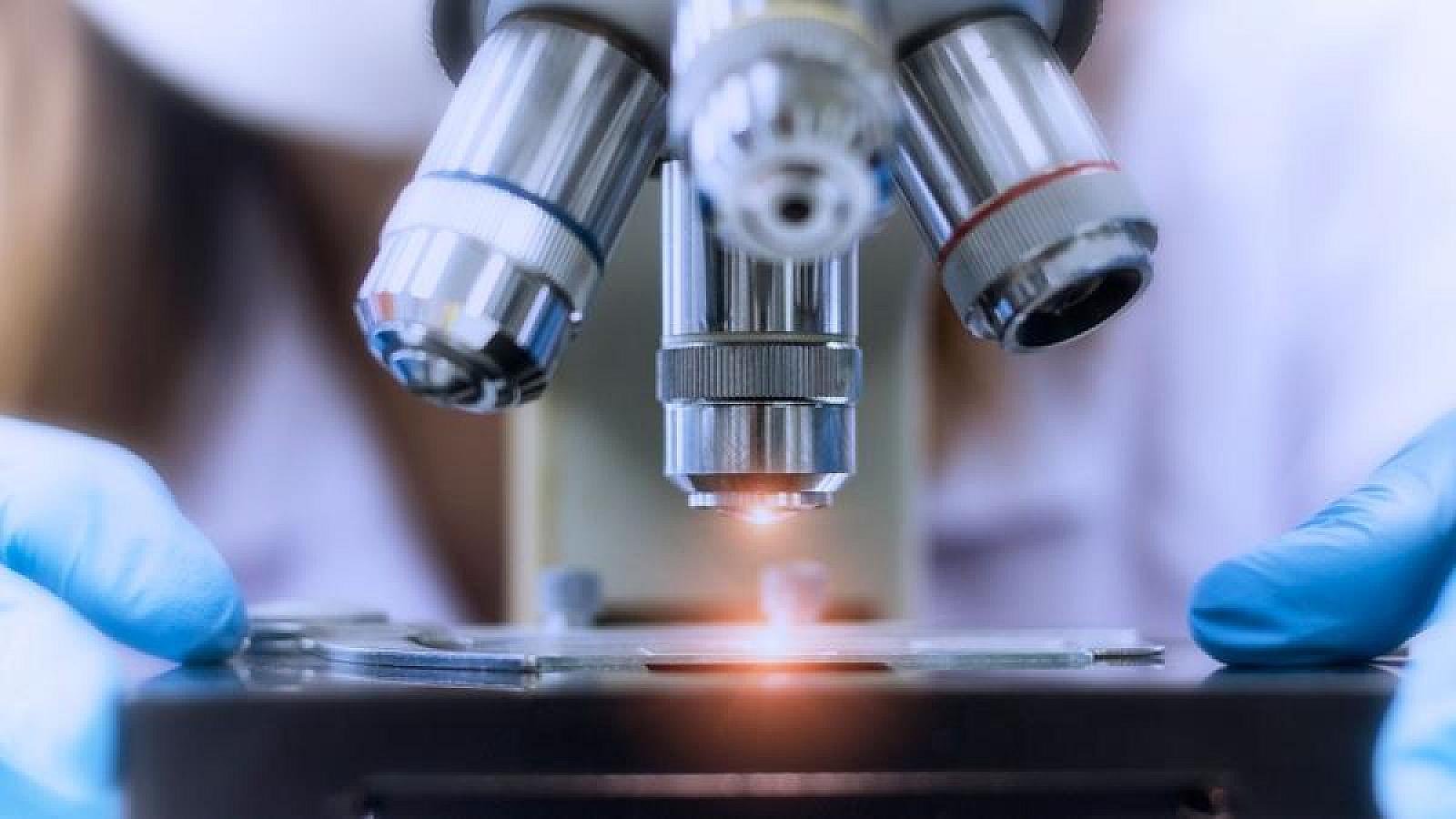 Alimlər ağciyər xərçəngində radioterapiyaya cavabı təyin edən