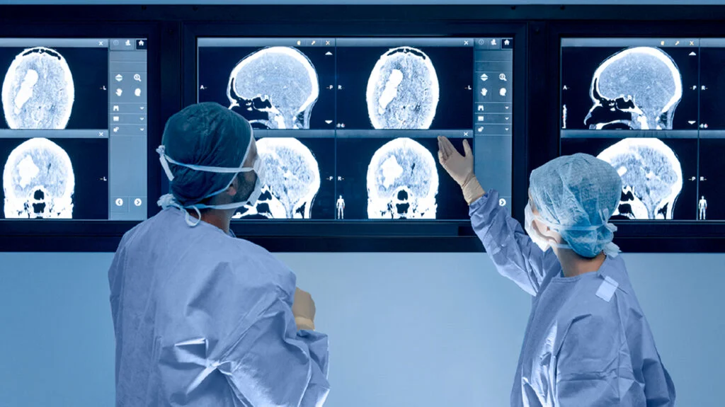 Alimlər yeni nevroloji xəstəlik