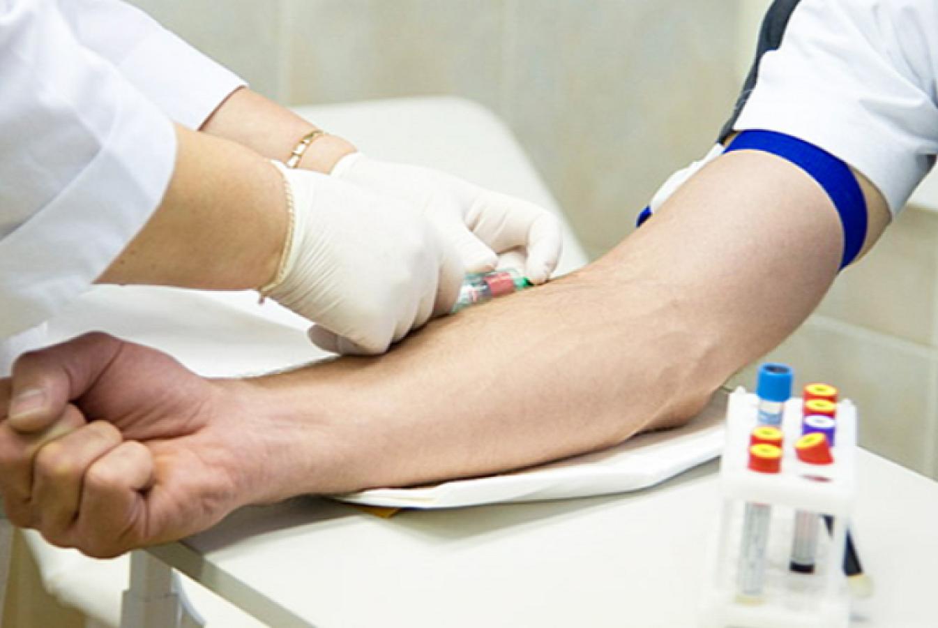 Analizə gedənlər bunu mütləq bilməlidir,