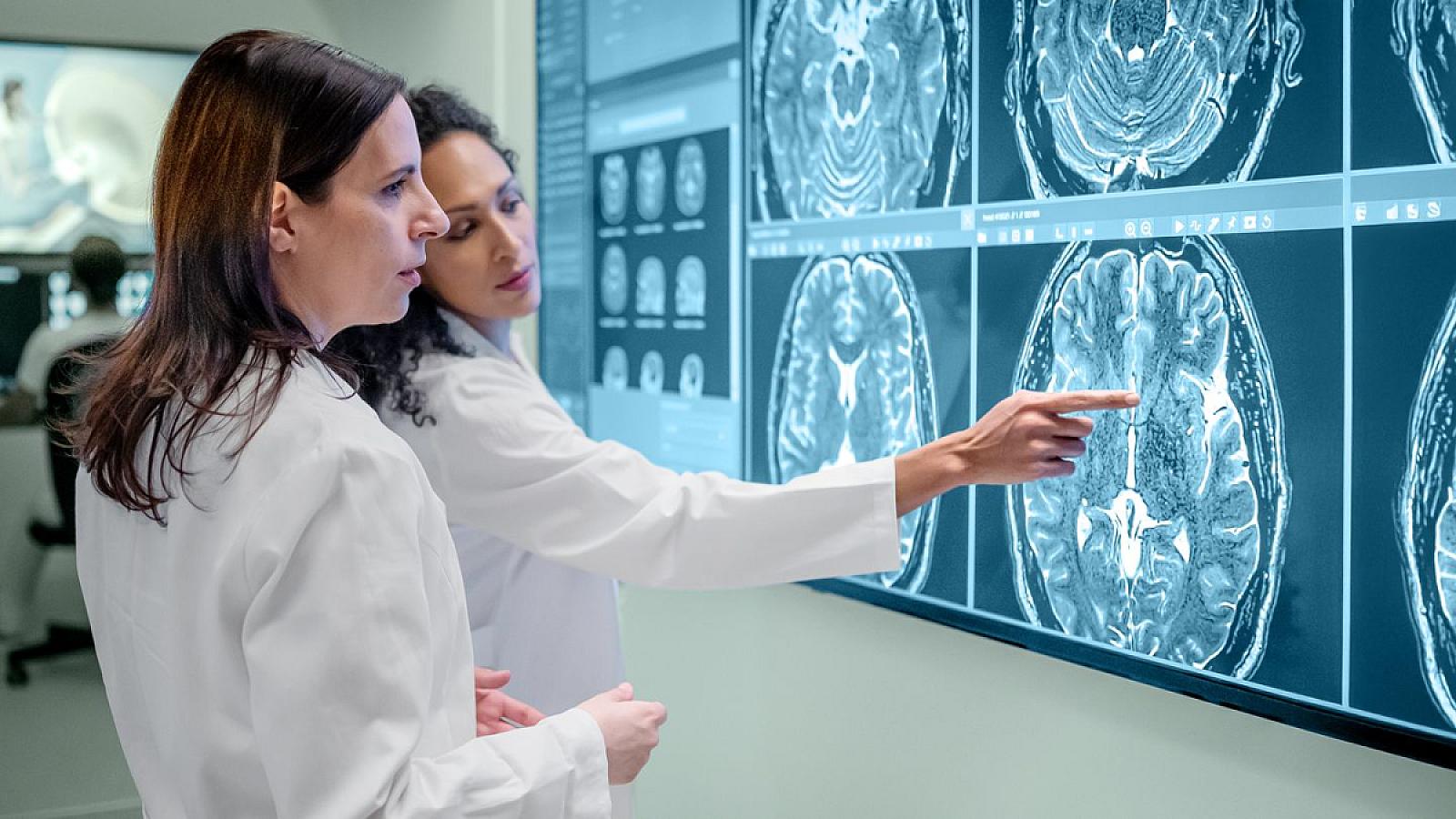 Alimlər cəmi 1 həftəyə beyin fəaliyyətini yaxşılaşdırmağın