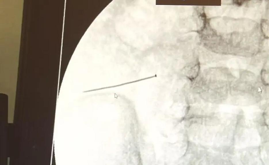 Daim ağlayan körpənin ağrısının səbəbi - 1