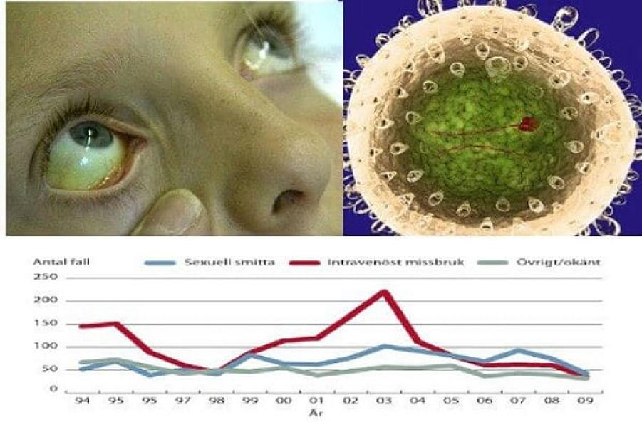 Qastroenteroloq-hepatoloq: “Hepatit A yaşlı insanlarda ölümə səbəb ola bilər” -