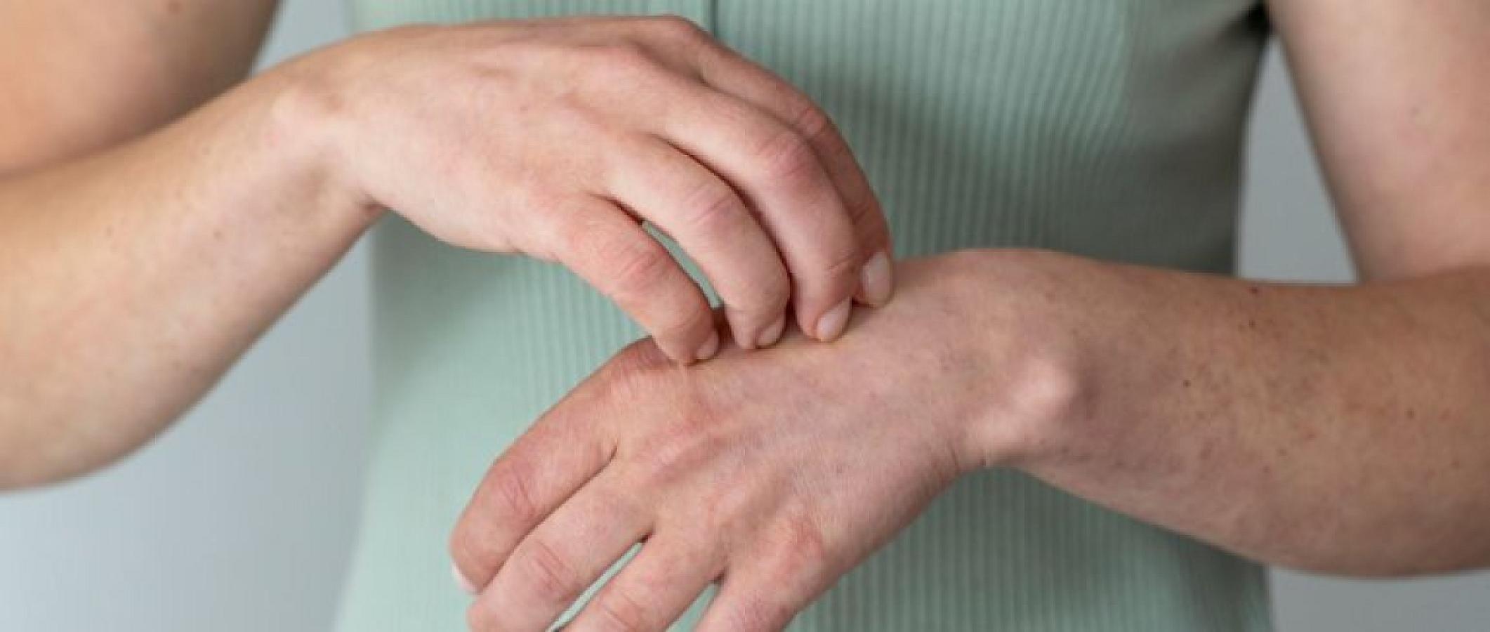 Bədəndə qurdun olduğunun