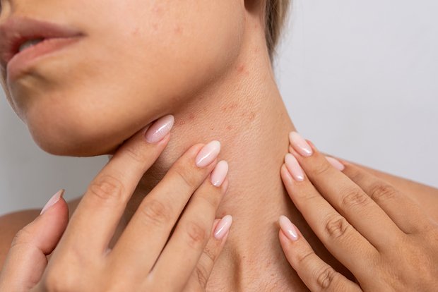 Dəridə görünən ciddi xəstəliklərin