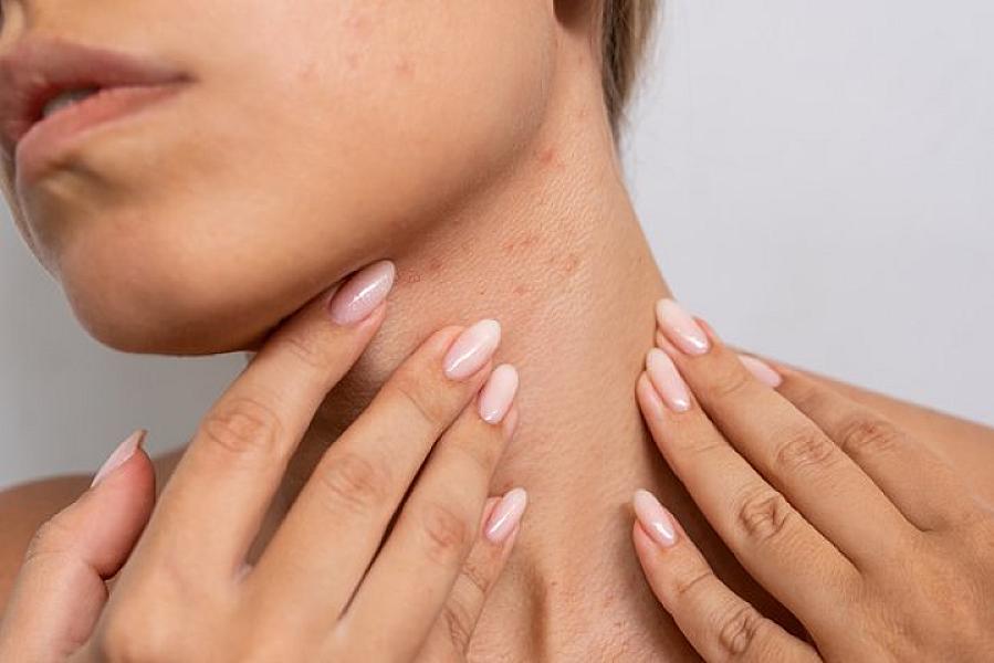 Dəridə görünən ciddi xəstəliklərin