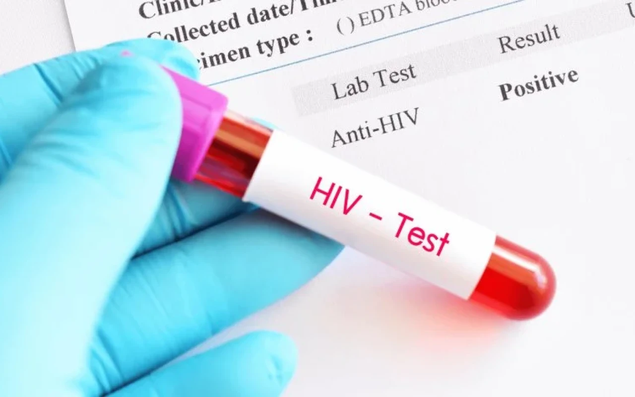 Azərbaycanda İİV-lə yaşayanların