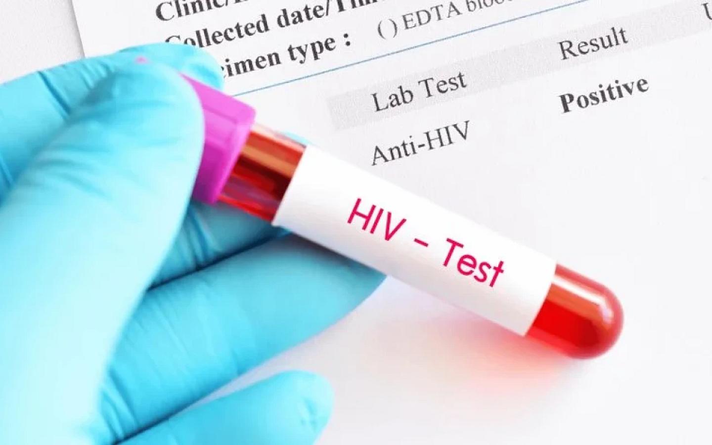 Azərbaycanda İİV-lə yaşayanların