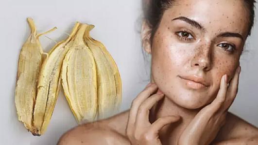 Doğum və günəş ləkələri üçün mükəmməl vasitə -