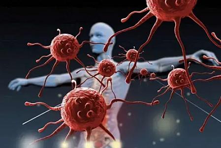 Xərçəng xəstəliyi ilə bağlı proqnoz -