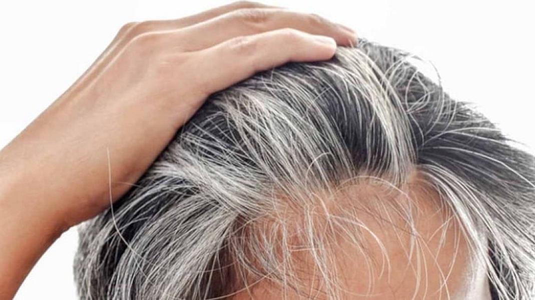 Ağ saçlar bizi xərçəngdən qoruyur? -