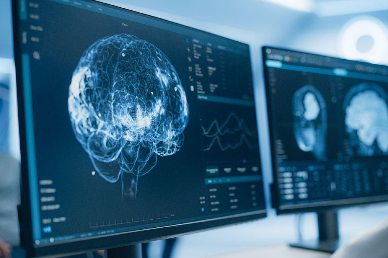 Beynin bərpasına kömək edən