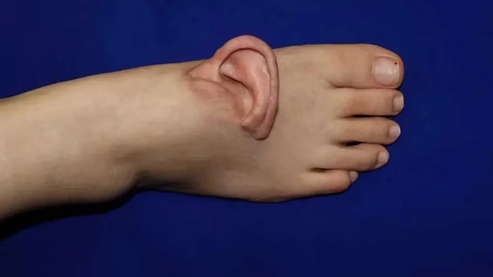 Çin tibb tarixində bir ilk: Kəsilmiş