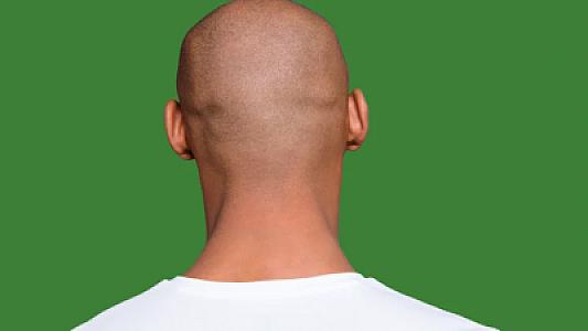 Başın ölçüsü nevroloji xəstəliklərə