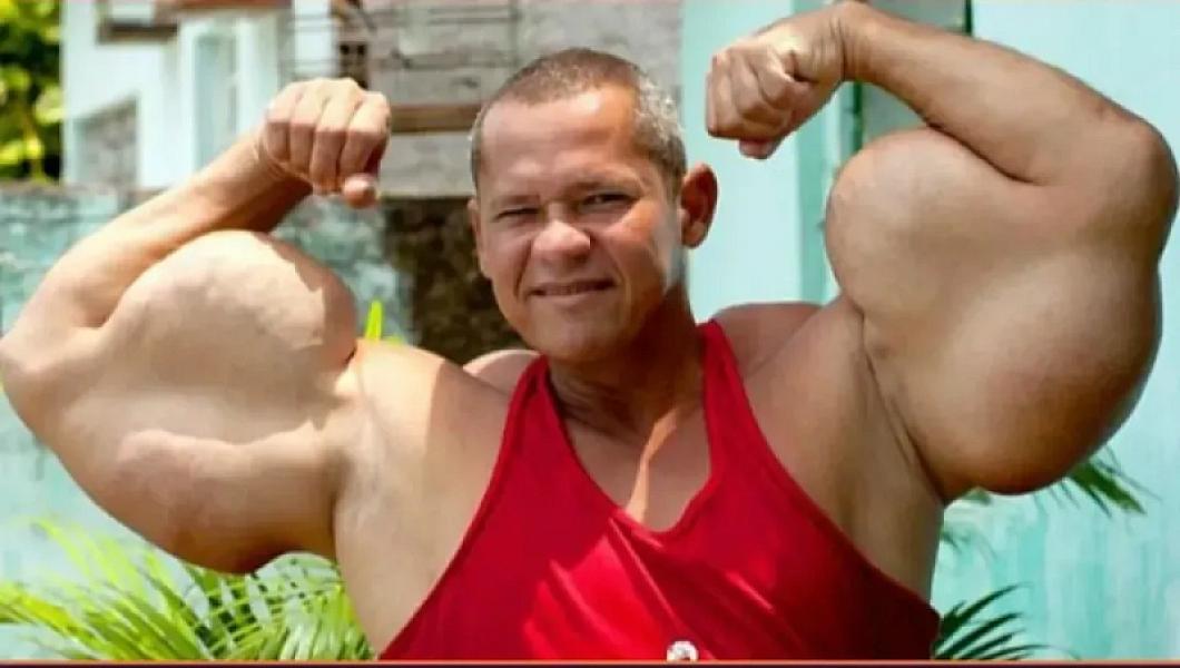 Biseps rekordu həyatı bahasına başa gəldi: