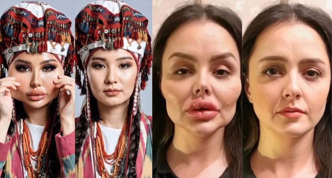 Süni gözəlliyə etiraz: Qazaxların başlatdığı trend