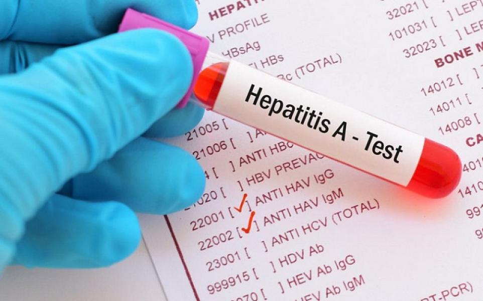 Nazirlik rəsmisi: "Hepatit A xroniki qaraciyər xəstəliyinə