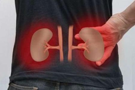 YENİLİK: Azərbaycanda böyrək daşlarını