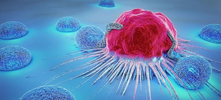 Alimlər üçlü terapiya ilə mədəaltı vəzinin şişində