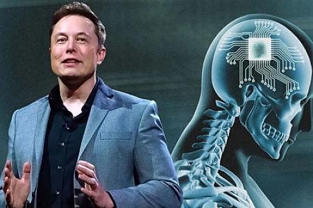 Dünyada bir ilk: İnsan beyninə