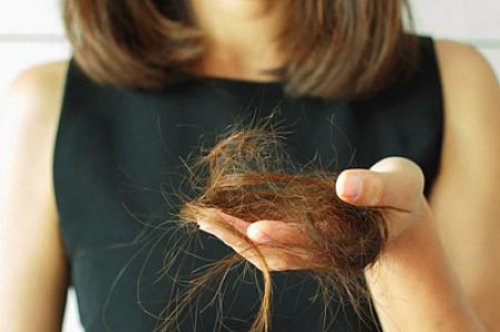 Bu şampunlar keçəlliyə səbəb olur