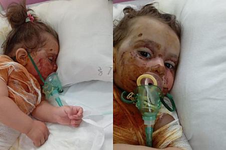 İki yaşlı Narının anası: “Yemək almağa belə pulum qalmayıb” -