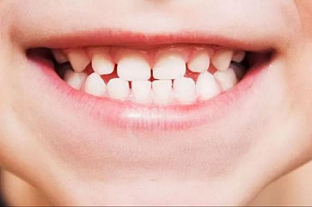 Yapon alimləri dişlərin yenidən böyüməsi üçün