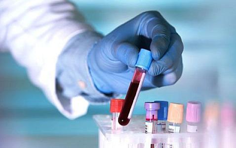 Azərbaycanda fantastik qiymətə analizlər -