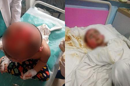 Yanğında xəsarət alan iki yaşlı Zeynəbin sizin köməyinizə ehtiyacı var -