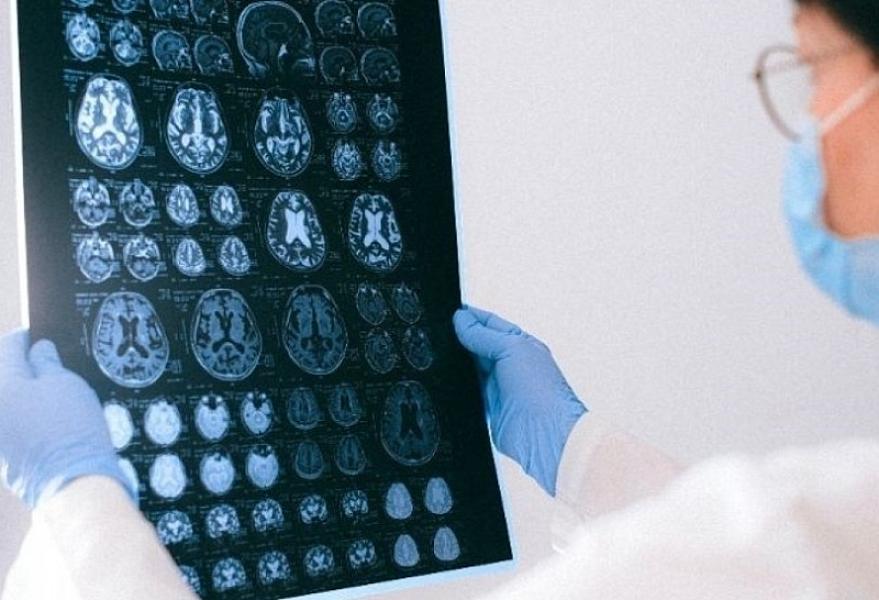 Dünyada ilk: 13 yaşlı uşaq ölümcül beyin xərçəngindən