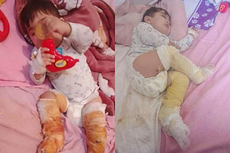 Körpə Muradın atası yardım fəryadı edir: