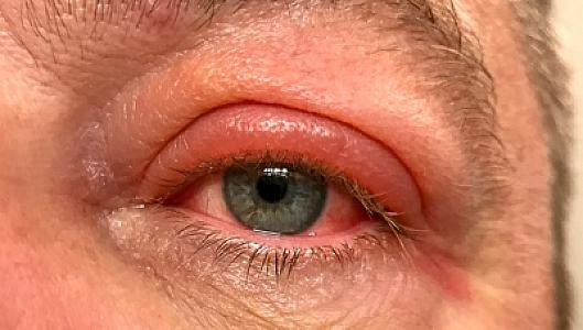 Sərxoş halda üzü üstə yatan