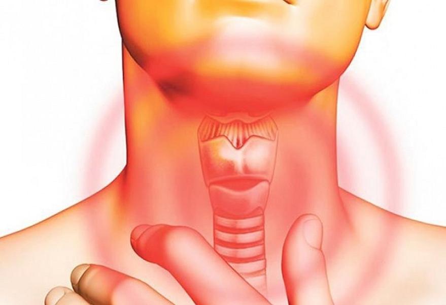 Səsin xırıltılı olması qırtlaq xərçənginin göstəricisi ola bilərmi? -