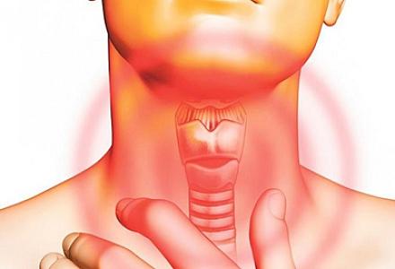 Səsin xırıltılı olması qırtlaq xərçənginin göstəricisi ola bilərmi? -