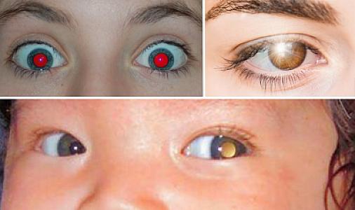 Fotolarda gözümüzün rəngi niyə bəzən qırmızı görünür?