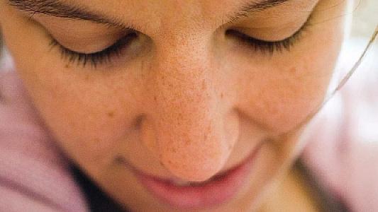 Dəri ləkəsi xərçəngə səbəb ola bilir