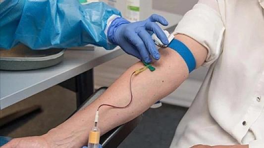 Dünyada hər il 20 milyondan çox insult hadisəsi baş verir