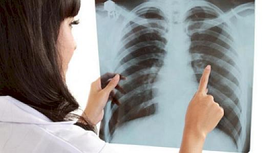 Bu xəstələr üçün ərzaq norması tətbiq ediləcək