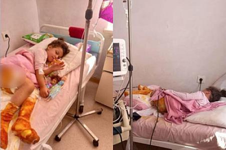 Qaynar suda yanan altı yaşlı Leylanın anası: “Son günlər