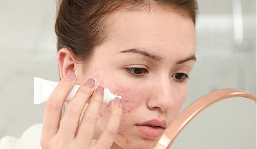 Sızanaq məhsullarında kanserogen maddə