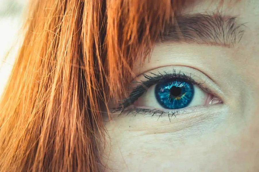 Gözlərdə yüksək xolesterol səviyyəsini necə təyin etmək olar?